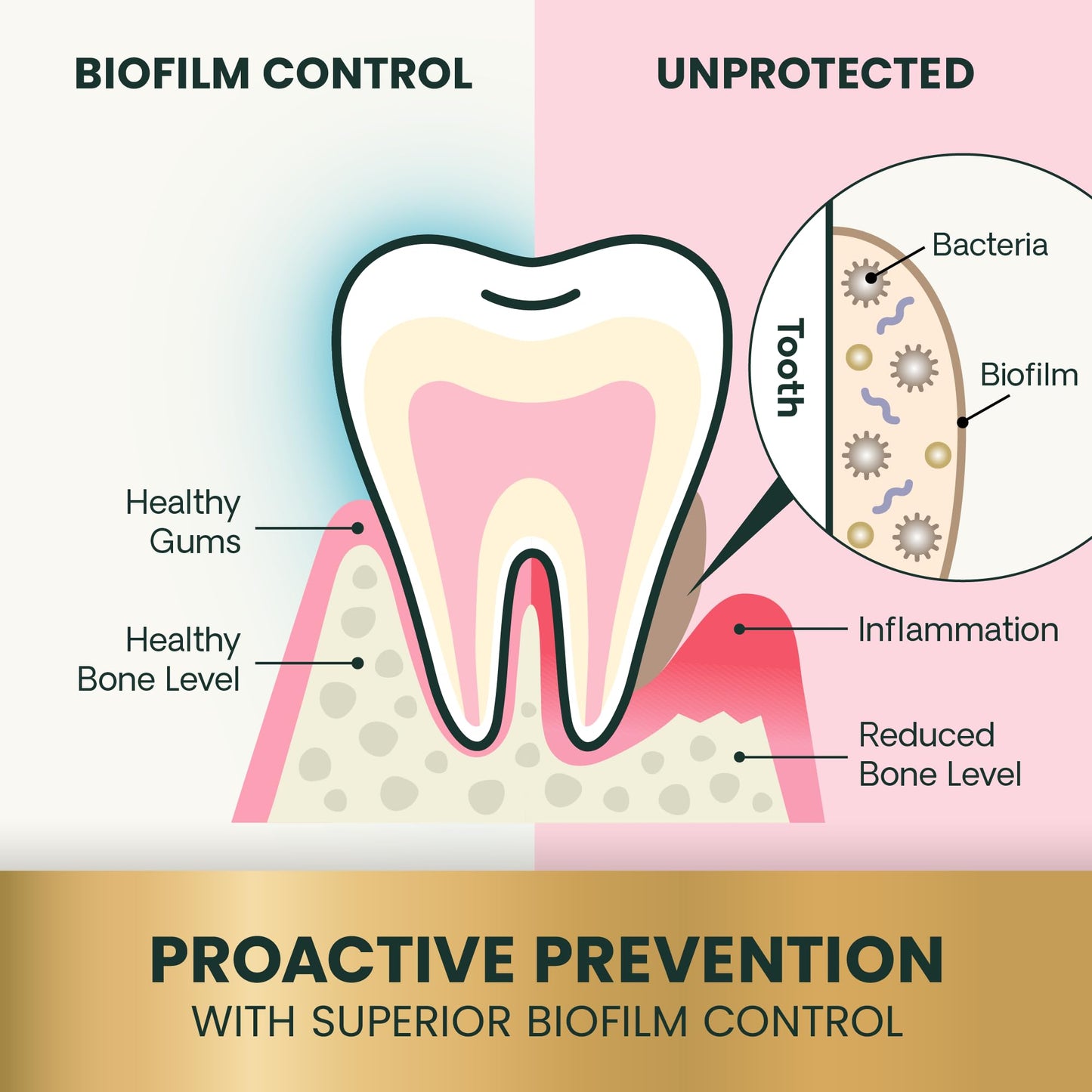 VetriScience Healthy Mouth Dental Chews, Perio Plus Sticks for Dogs, with Probiotics, Spirulina & Zeolites, Breath Freshening, Plaque & Tartar Control, Chicken, 30 Count
